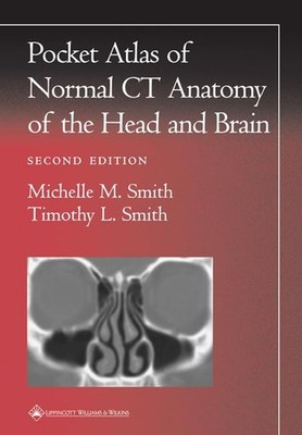 Pocket Atlas of Normal CT Anatomy of the Head and Brain by Smith MD