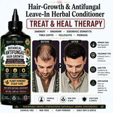 Hair Growth Serum – Antifungal Scalp Defence & Hydrating Living Conditioner