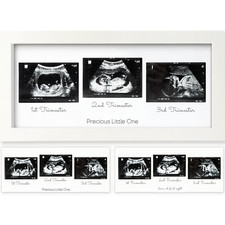 Marcos de fotos para ecograf as de beb s - Trio Ultrasound