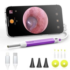 AnyScope Digital Otoscope with Gyroscope, HD Ear Camera with Ear Wax Removal Too