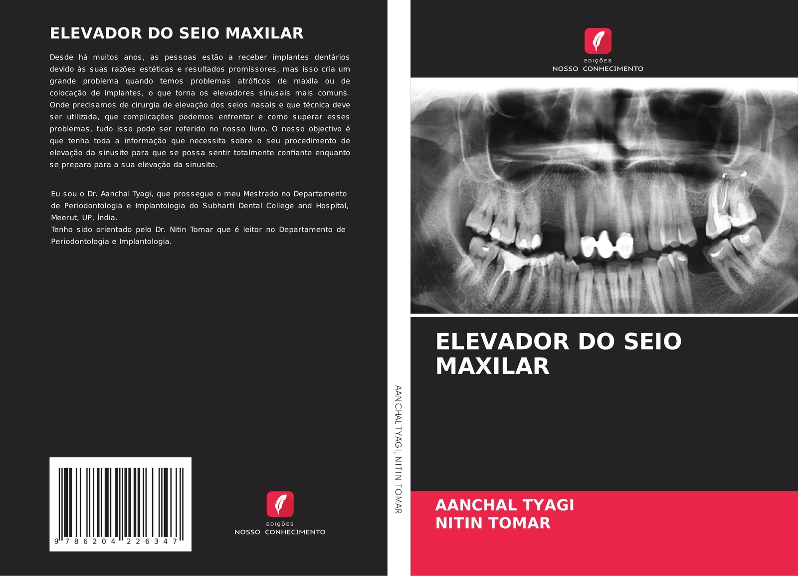 Aanchal Tyagi (u. A.) | Elevador Do Seio Maxilar | Taschenbuch |