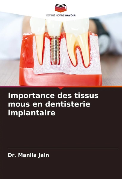 Manila Jain | Importance Des Tissus Mous En Dentisterie Implantaire | Buch-image