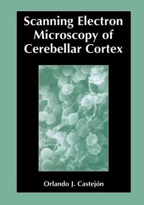 Scanning Electron Microscopy of Cerebellar Cortex Orlando Castejón