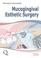 Mucogingival Esthetic Surgery Giovanni Zucche...
