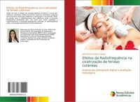 Efeitos Da RadiofrequêNcia Na CicatrizaçãO De Feridas CutâNeas Ana Maria Cardoso