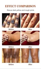 Strong Whitening Dark Skin Knuckles Feets Knees Elbows Armpit Inner Thigh Serum