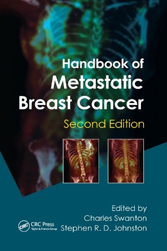 Handbook of Metastatic Breast Cancer - 9780367382186