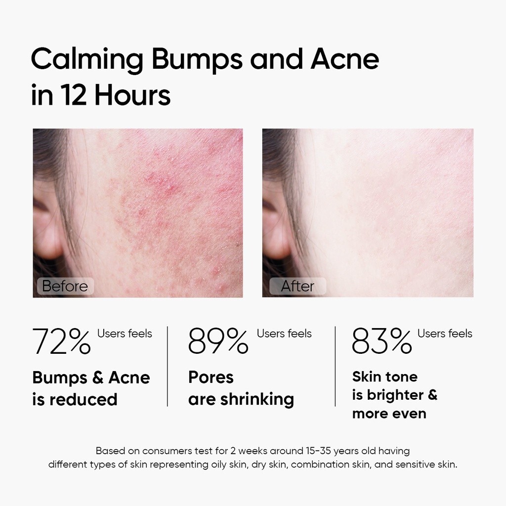 SKINTIFIC Mugwort Mask Anti Pores&Acne Clay Mask 55g Relieves Acne Moisturizing