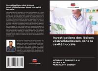 Investigations Des LéSions VéSiculobulleuses Dans La Cavité Buccale M (U. A.)