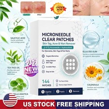 2026 NEW Curalona Microneedle Patches 144pcs, Skin Tag Wart Acne Remover Patches