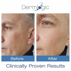 skin lightener for dark spots