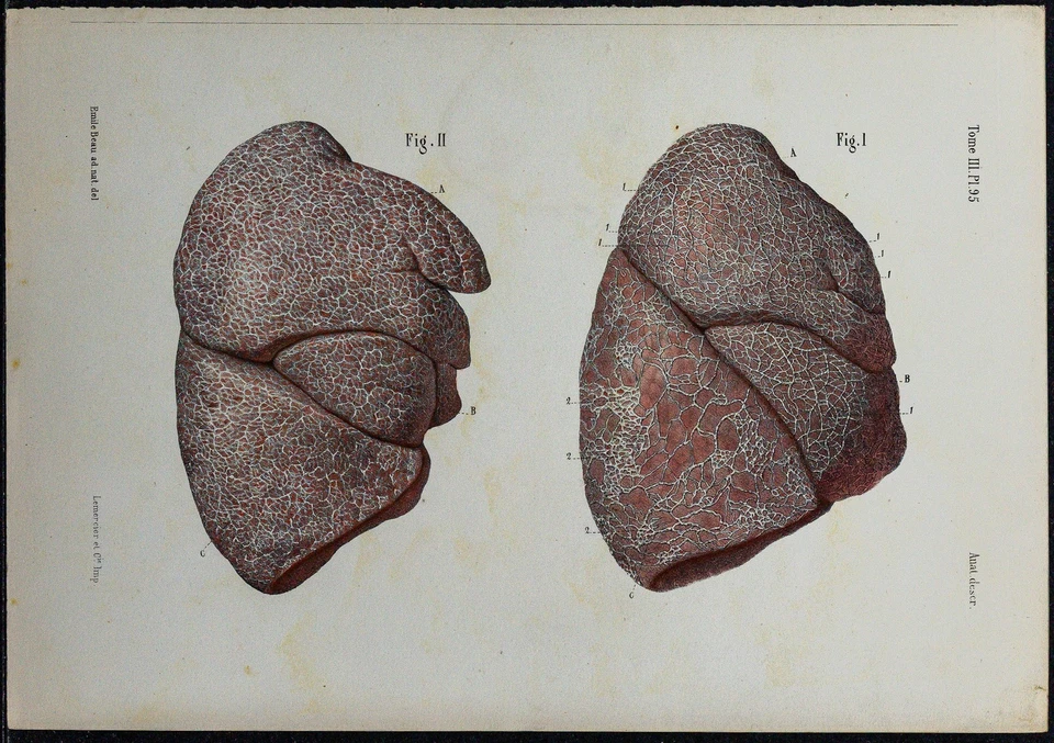 1866 - Lungs & Starships - Anatomy & Angiology - engraving antique