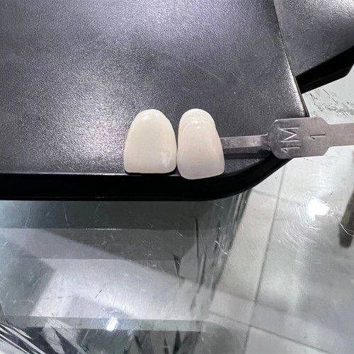 Bloques de disilicato de litio dental Cerec C14 vidrio cerámica 5 piezas - Imagen 10 de 12