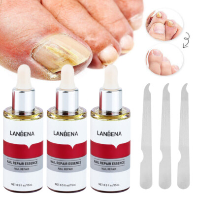 3 X Nail Repair Serum Fungal Nail Treatment Liquid Remove Toe Nail Fungus Serum