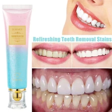 Niacinamide Whitening Toothpaste,Natural Niacinamide Toothpaste,Teeth Whitening
