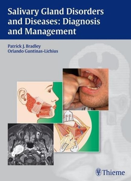 Patrick J. Bradley / Salivary Gland Disorders And Diseases9783131464910-image