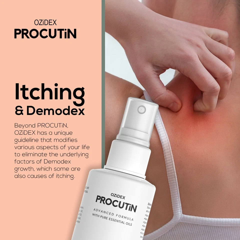 Tratamento de ácaros Demodex para acne rosácea dermatite blefarite coceira perda de cabelo - Imagem 4 de 4