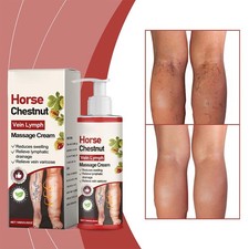 Horse Chestnut Varicose Veins Lymph Massage Cream 100g Eliminate E us - X1F5