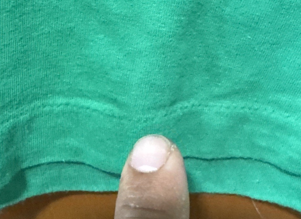 Foto 3 di 5