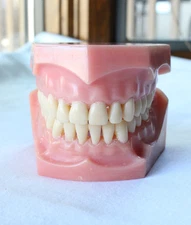 Vintage Dental Model for Teaching or Demonstration Anatomical Set Teeth & Gums