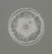 W.A.Firth Antique Microscope Slide. Aulacodiscus Molleri Diatom