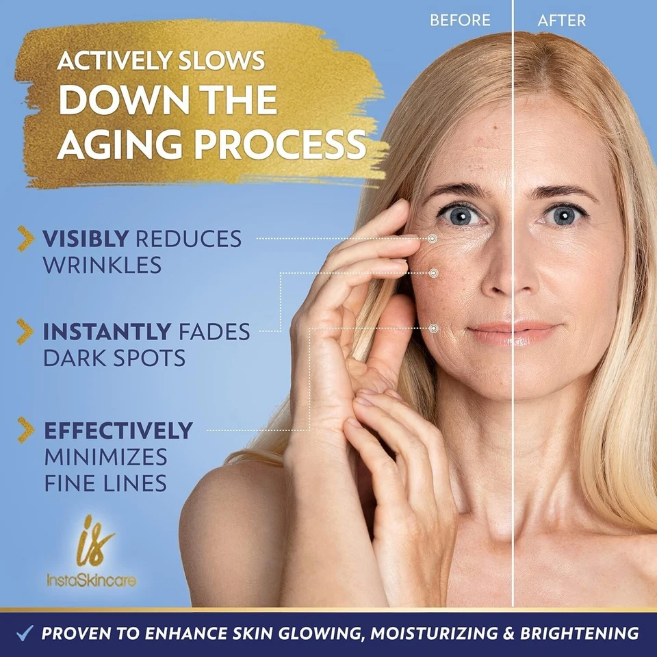 Niacinamid Serum 8 Unzen für Gesicht 10 % mit Zink 1 % Vitamin B3 Aufhellendes Serum - Bild 3 von 4