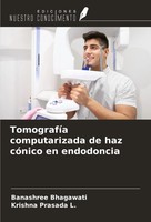 Banashree Bhagawati (U. A.) | TomografíA Computarizada De Haz CóNico En...
