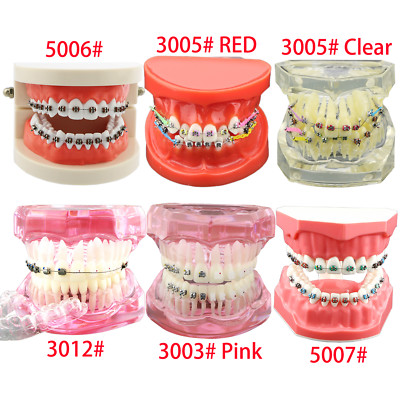 Orthodontic Teeth Dental Model + Metal Ceramic Bracket Tube Self-ligating Chain 