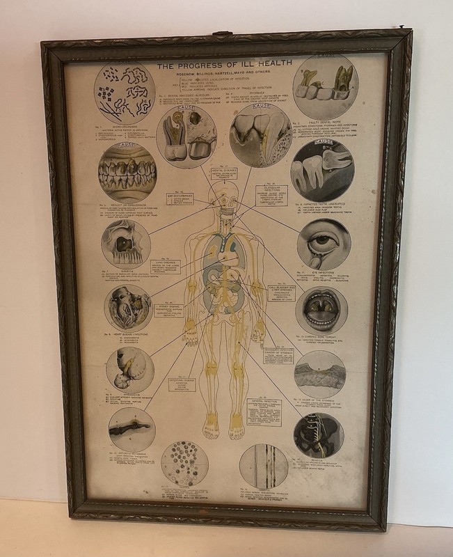 Antique Framed Human Diagram “The Progress Of Ill Health” By Rosenow, Billings