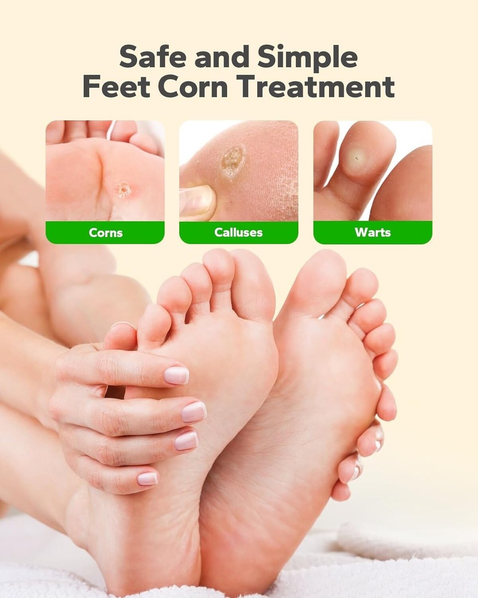Corn Removal Patch For Toes Feet (36 Patches), Foot Corns Health