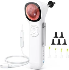 ScopeAround 3.9mm Ear Otoscope Camera with 1.45" IPS Screen Ear Wax Removal Tool