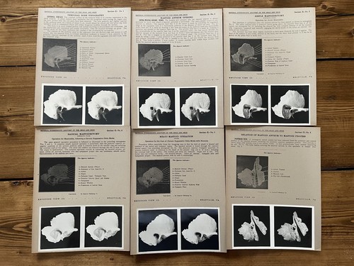 Colección de tarjetas estereoscópicas - ANATOMÍA DE EDIMBURGO VOL 10 CALAVERA Y OREJA - Juego de vista estéreo - Imagen 3 de 12
