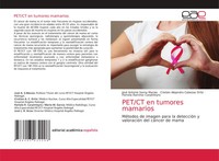 José Antonio Serna Macias (U. A.) | Pet/Ct En Tumores Mamarios | Taschenbuch