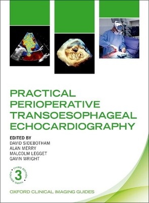 David Sidebotha Practical Perioperative Transoesophageal (Paperback) (UK IMPORT)