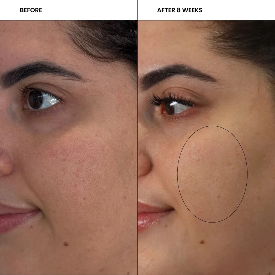 Skin Pharm Crystal Clear Clarifying Pads - 60ct w/2% Salicylic Acid - Image 4 of 4