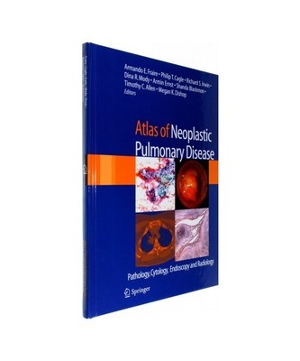 Atlas of Neoplastic Pulmonary Disease: Pathology, Cytology, Endoscopy and Radiol