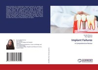 Implant Failures Anju Aggarwal