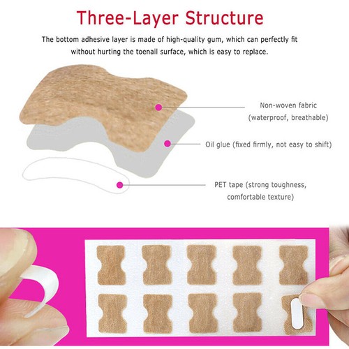 Self Adhesive Ingrown Toenail Corrector Toe Foot Nail Sticker Pedicure Tool US - Picture 6 of 14