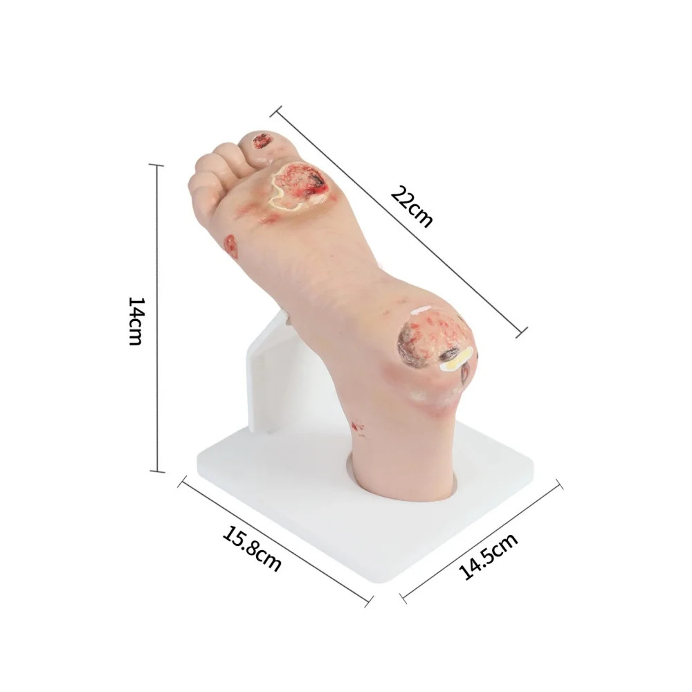 Diabetic Foot Care Model PVC Material for Medical Science Teaching