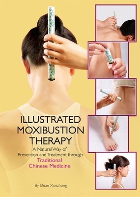 Duan Xuexhong The Illustrated Moxibustion Therap (Gebundene Ausgabe) (US IMPORT)