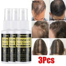 3Pcs 5% Minoxidil Hair Growth Serum Spray for Healthier and Thicker Hair, 60mL