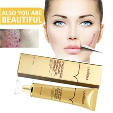 Best Scar removal Cream Skin Care for Scars Reduce Surgery Acne Stretch Marks