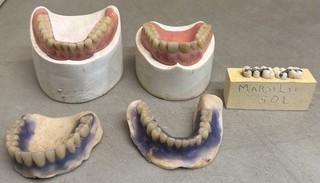 Vintage Dental Oddity Plaster Tooth Teeth Molds Dentist Cast Impressions