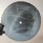 LED ZEPPELIN ROCK&ROLL X-Ray USSR Record Roentgen Bone Ribs Music Vinyl