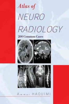 Atlas of Neuroradiology : 200 Common Cases, Paperback by Haouimi, Ammar, Bran...