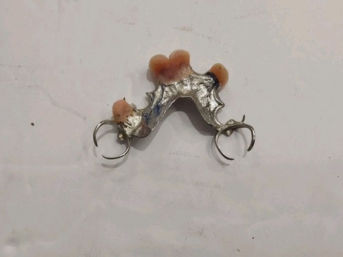 Vintage  Removable Partial Denture. Used.