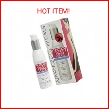 Advanced Clinicals Crepey Skin Wrinkle Smoothing Skin Care Cream Moisturizer For