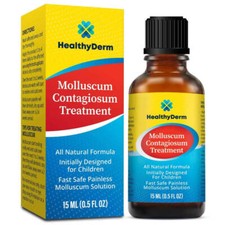 Molluscum Contagiosum Treatment, Fast, Safe, ...