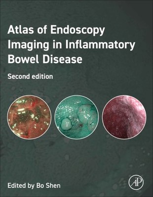 Atlas of Endoscopy Imaging in Inflammatory Bowel Disease, Hardcover by Shen, ...
