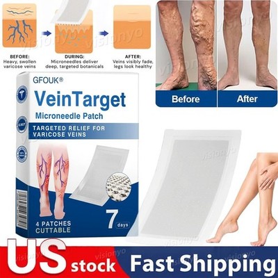 4-20 Pcs Vein Target Microneedle Patch Advanced Legs Varicose Veins Treatment 